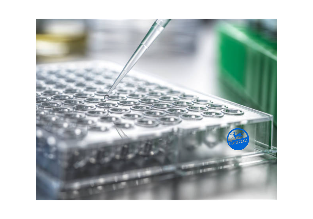 ELISA   ACPP anti-